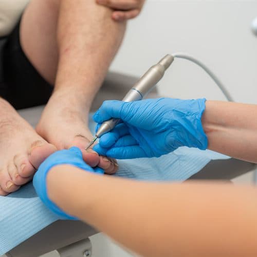 Podología en A Guarda para el cuidado de sus pies